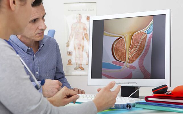 Ai primi sintomi di prostatite, dovresti consultare immediatamente un medico